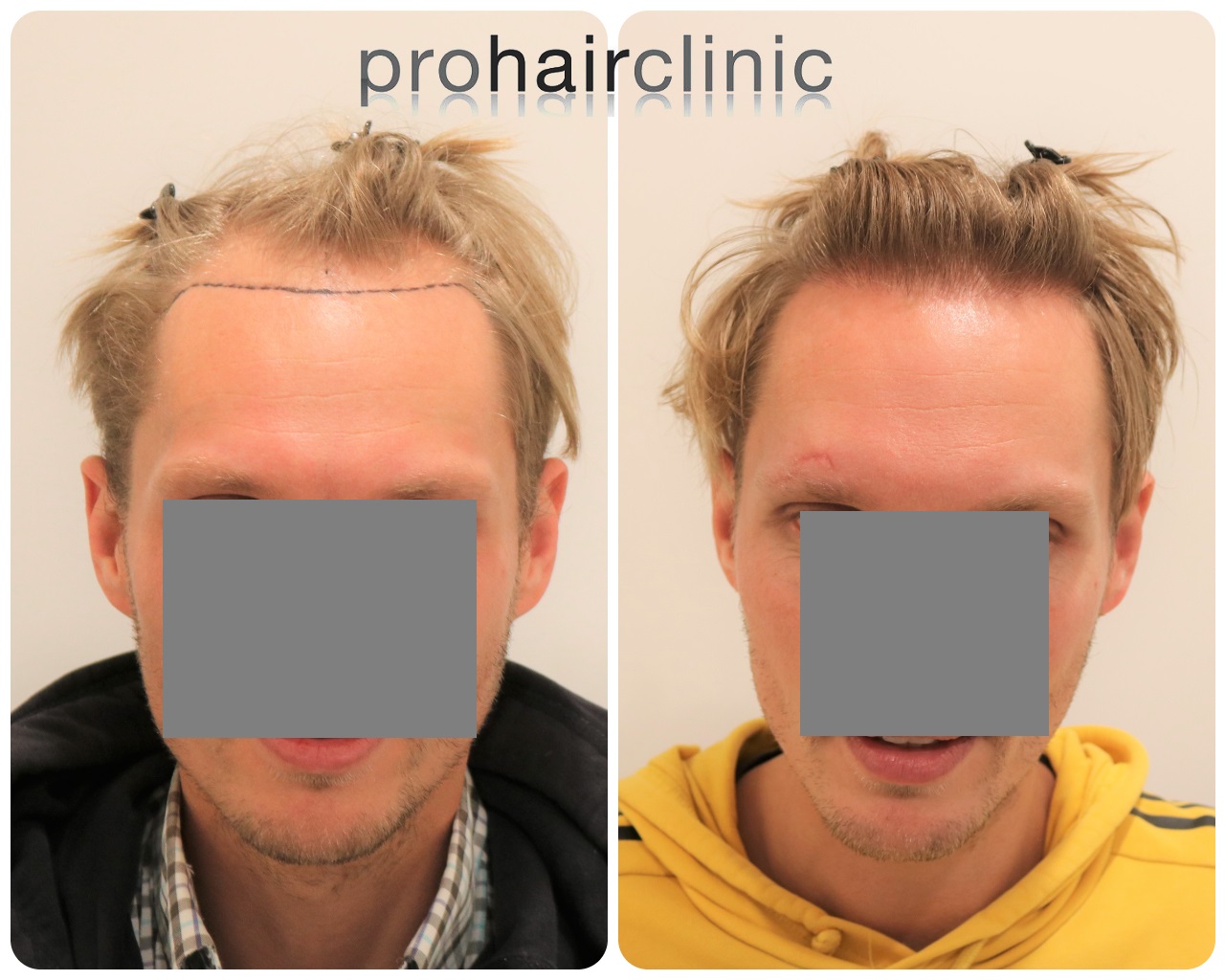 /foren/transplant/index.php/fa/54050/0/