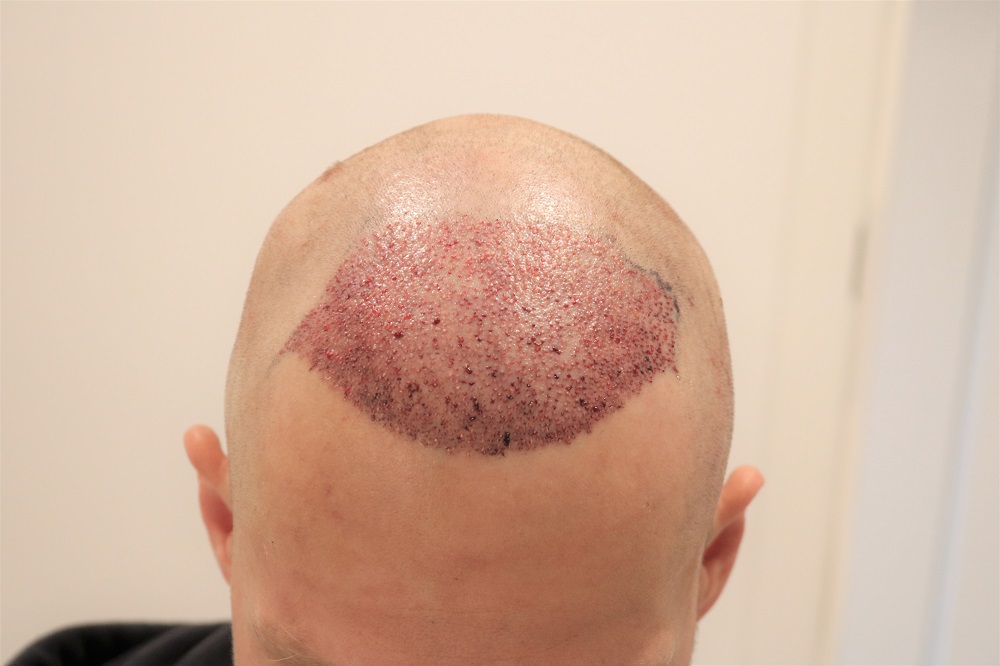 /foren/transplant/index.php/fa/54070/0/