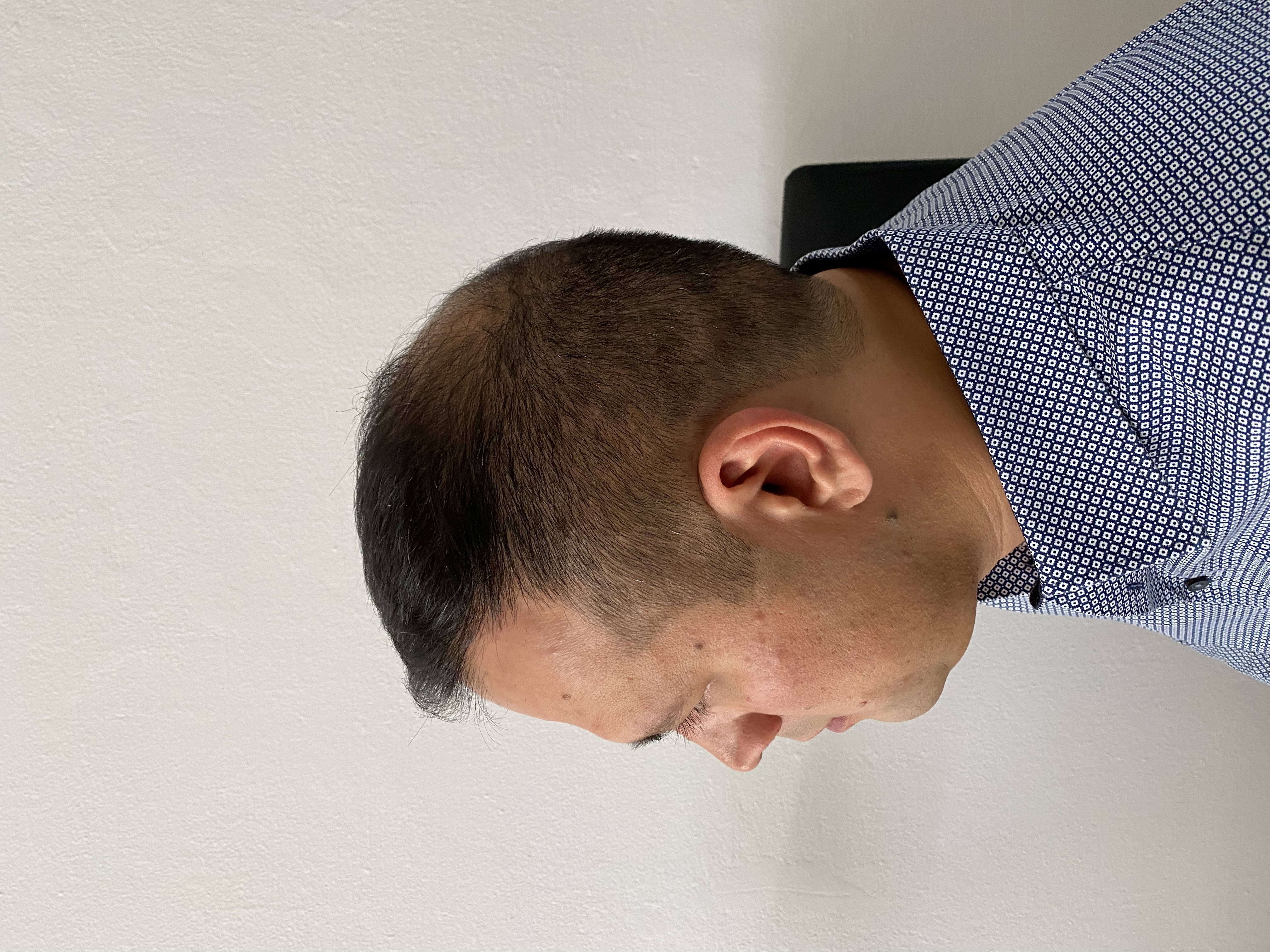 /foren/transplant/index.php/fa/54072/0/