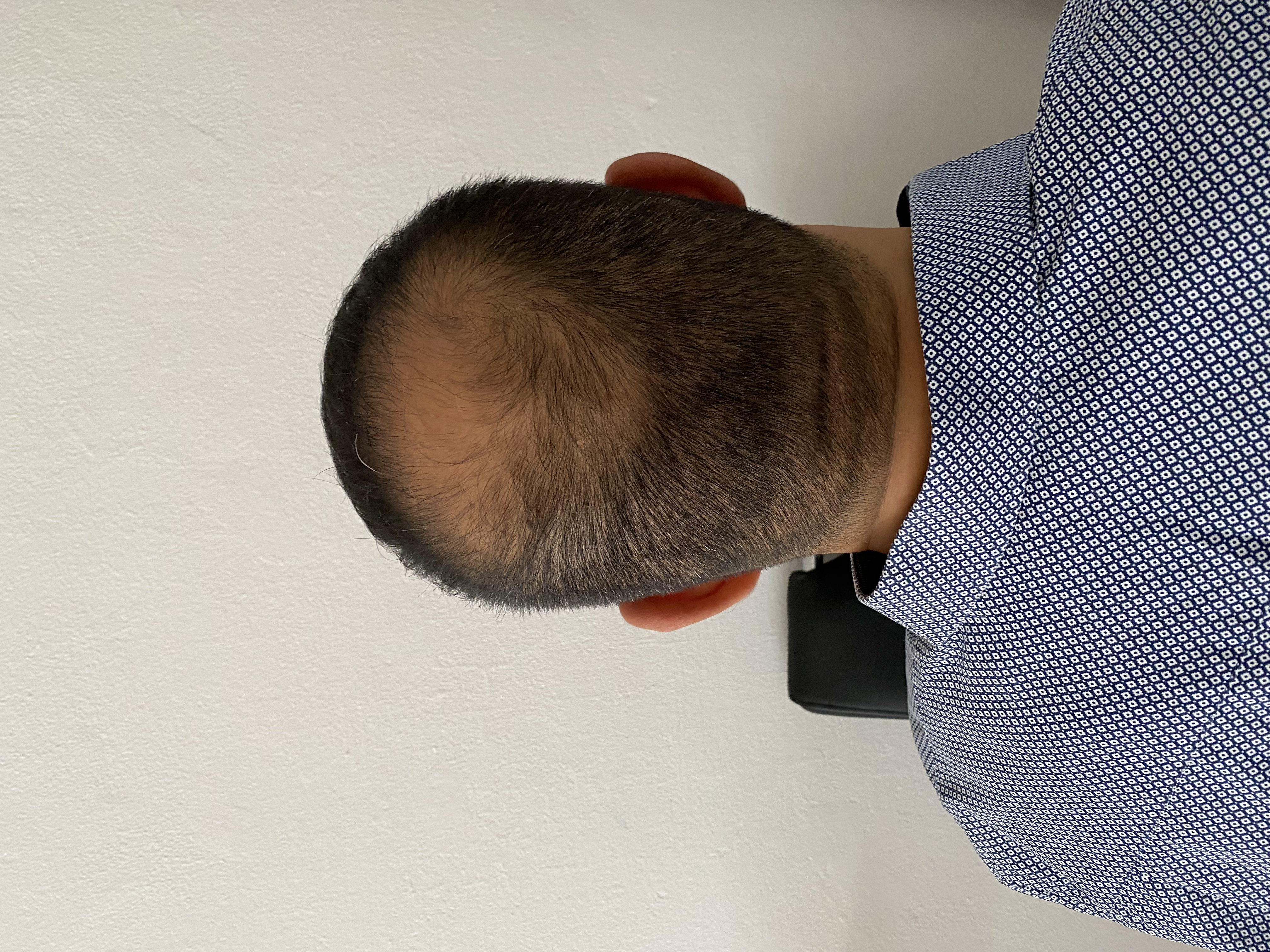 /foren/transplant/index.php/fa/54074/0/