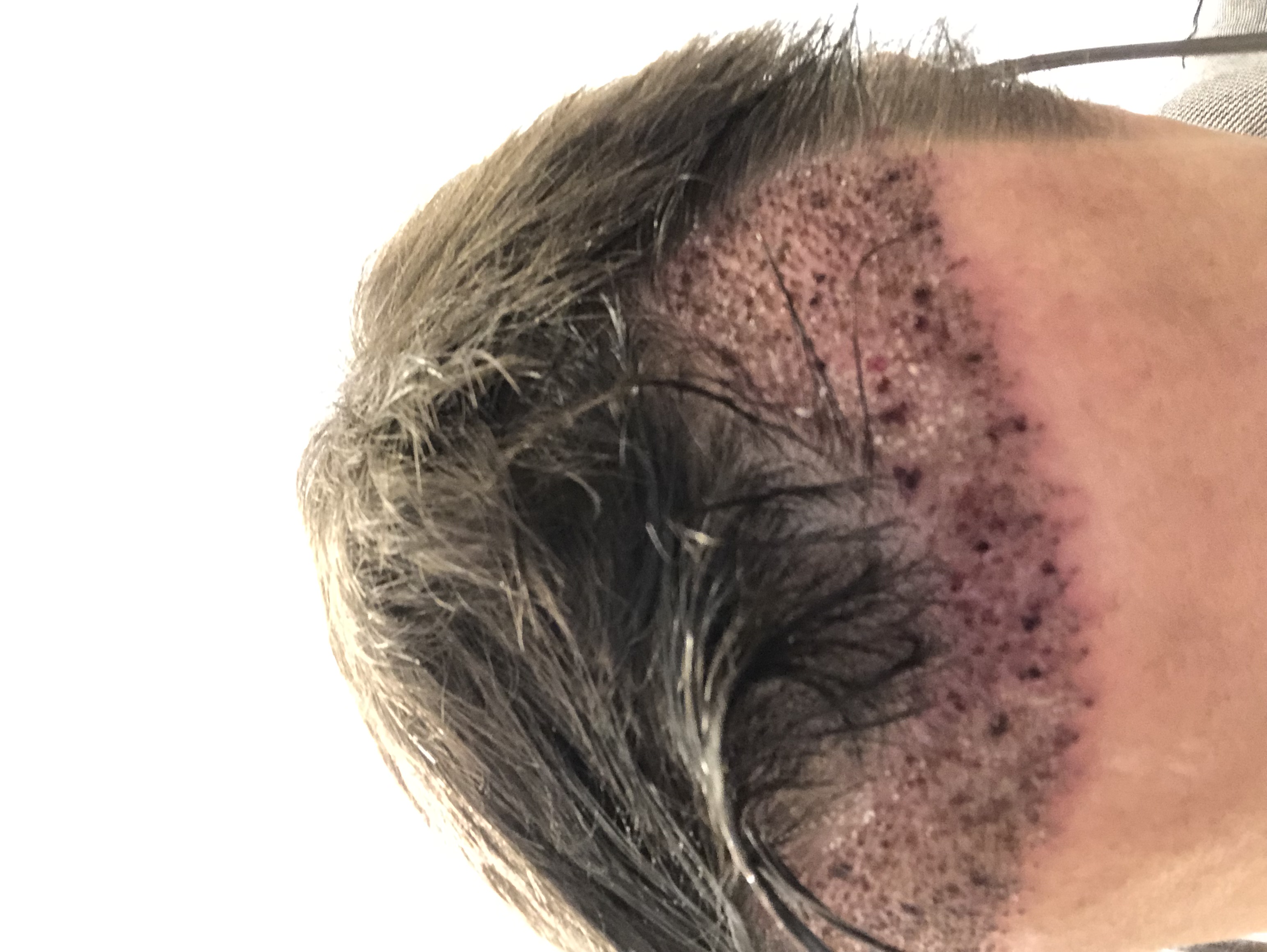 /foren/transplant/index.php/fa/54136/0/