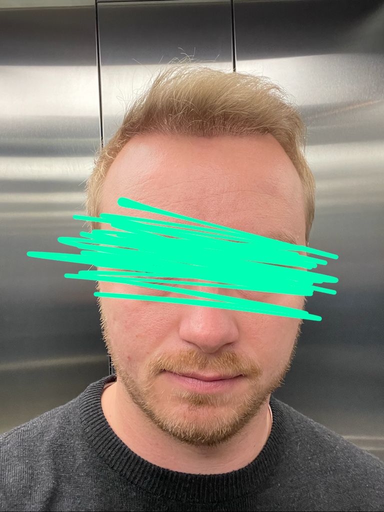 /foren/transplant/index.php/fa/54137/0/