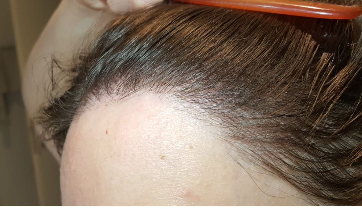 /foren/transplant/index.php/fa/54138/0/