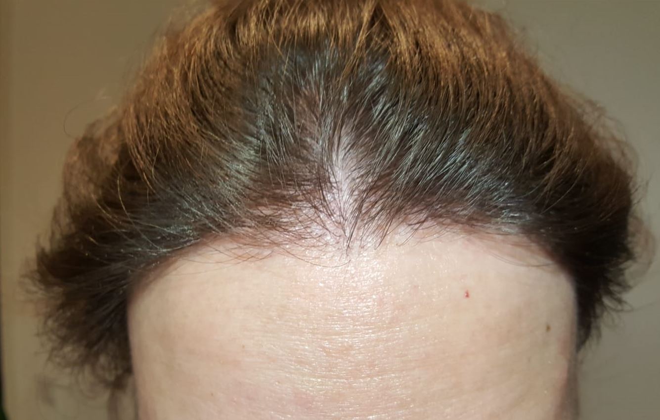 /foren/transplant/index.php/fa/54140/0/