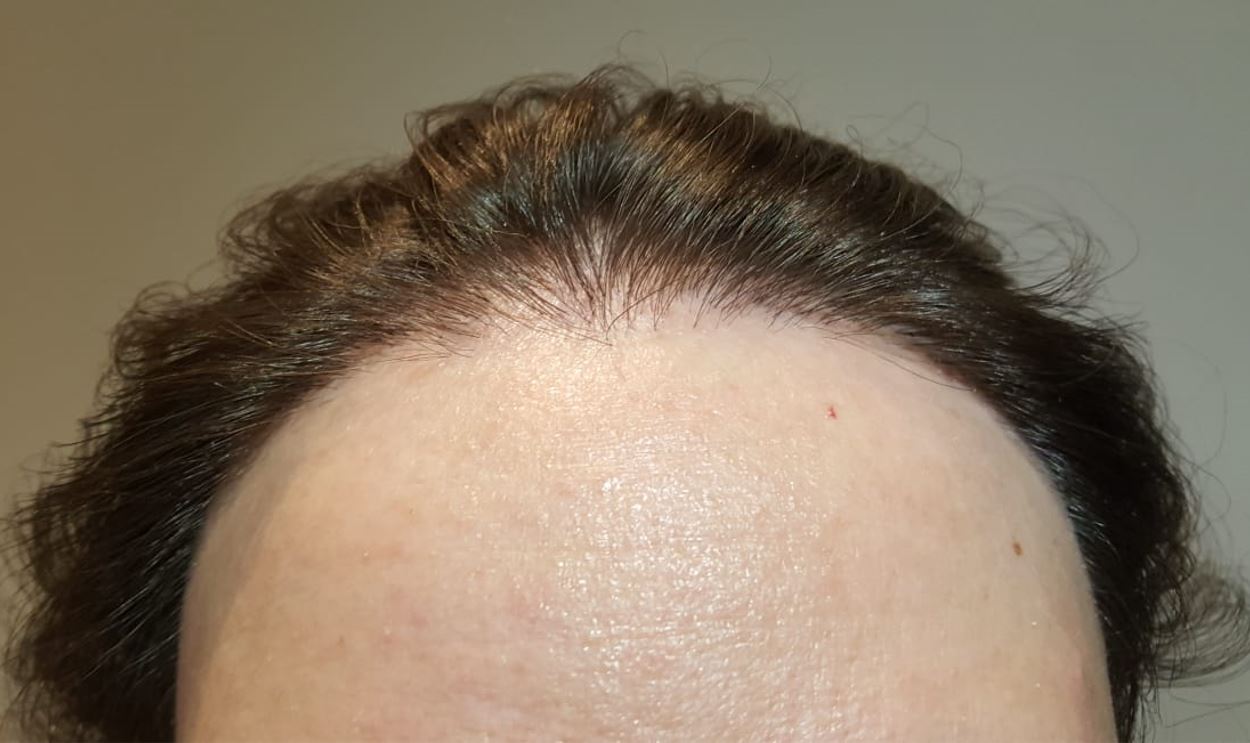 /foren/transplant/index.php/fa/54141/0/