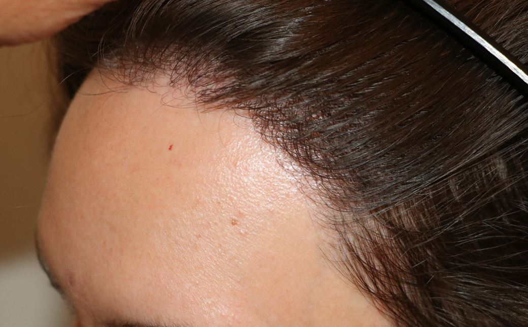 /foren/transplant/index.php/fa/54142/0/