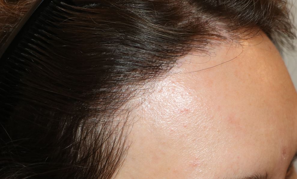 /foren/transplant/index.php/fa/54143/0/