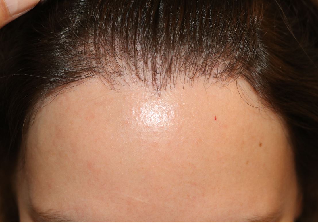 /foren/transplant/index.php/fa/54144/0/