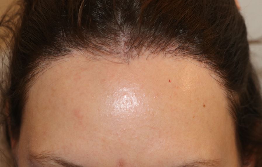 /foren/transplant/index.php/fa/54145/0/