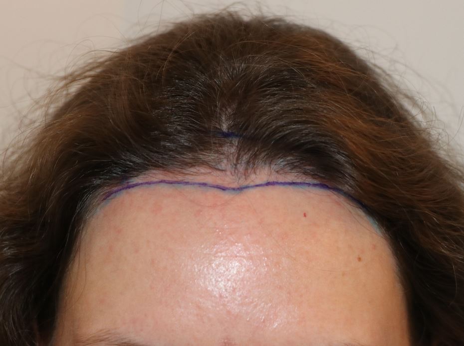 /foren/transplant/index.php/fa/54146/0/