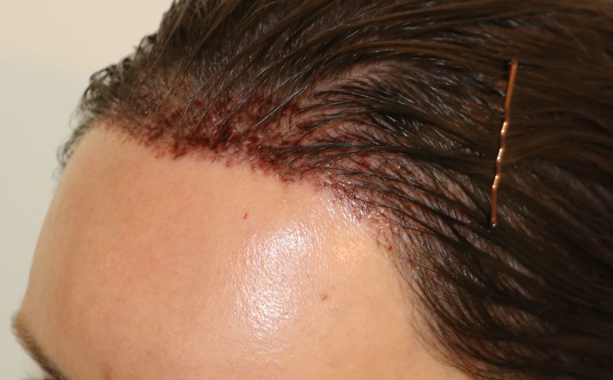 /foren/transplant/index.php/fa/54148/0/