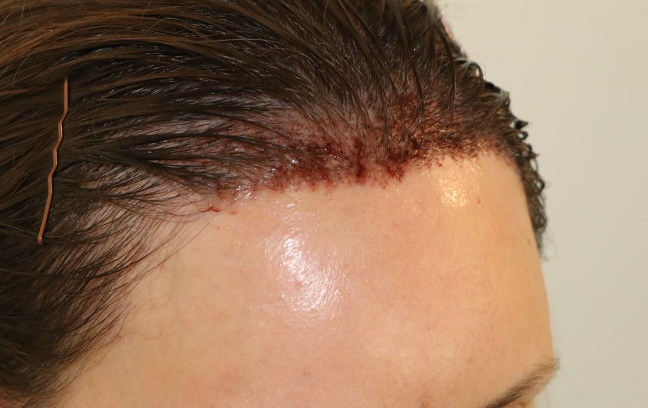 /foren/transplant/index.php/fa/54149/0/