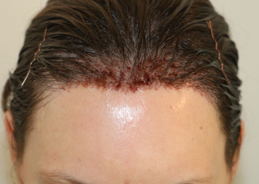 /foren/transplant/index.php/fa/54150/0/