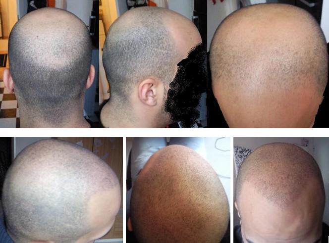 index.php/fa/5416/0/