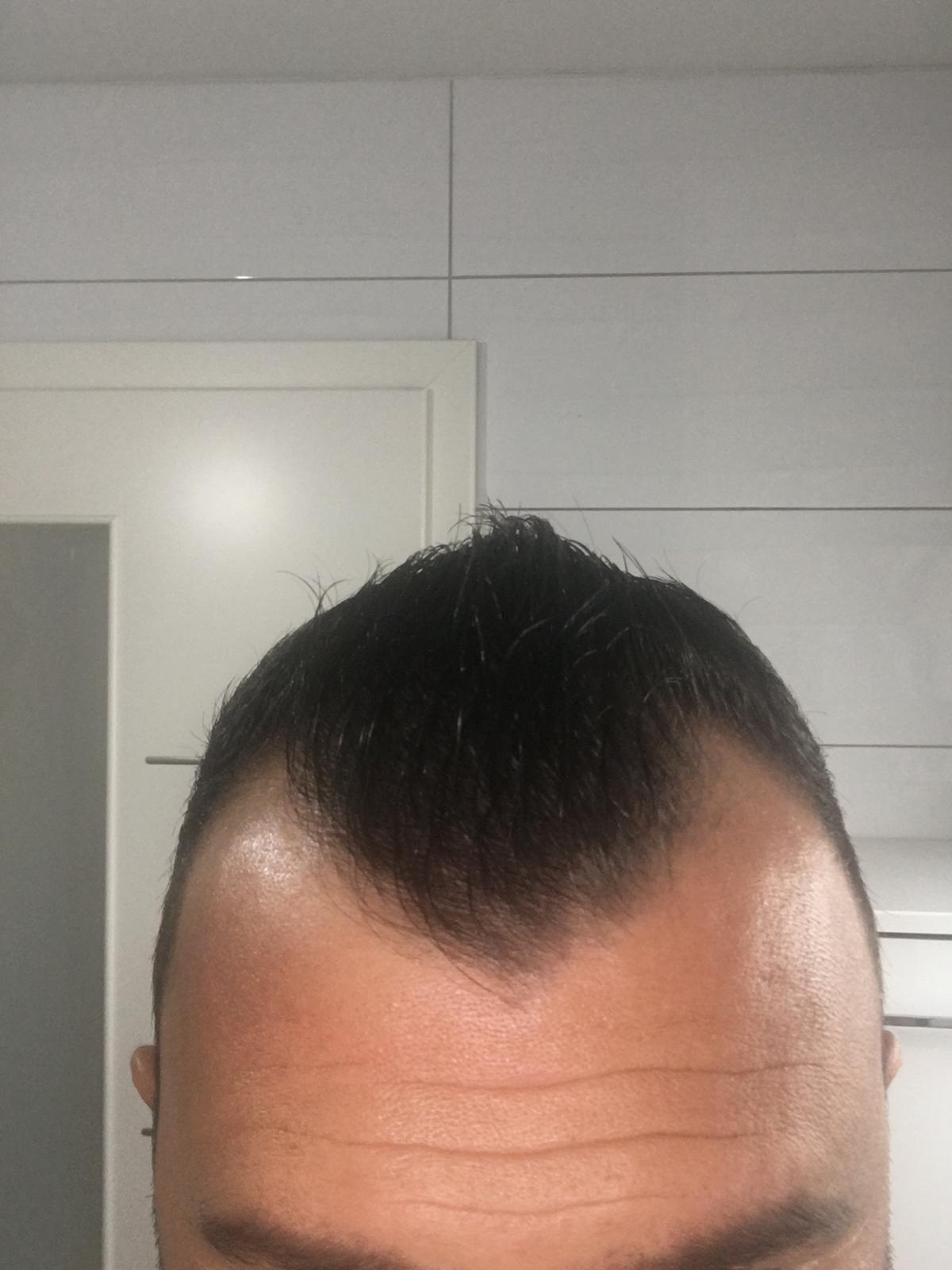 /foren/transplant/index.php/fa/54177/0/