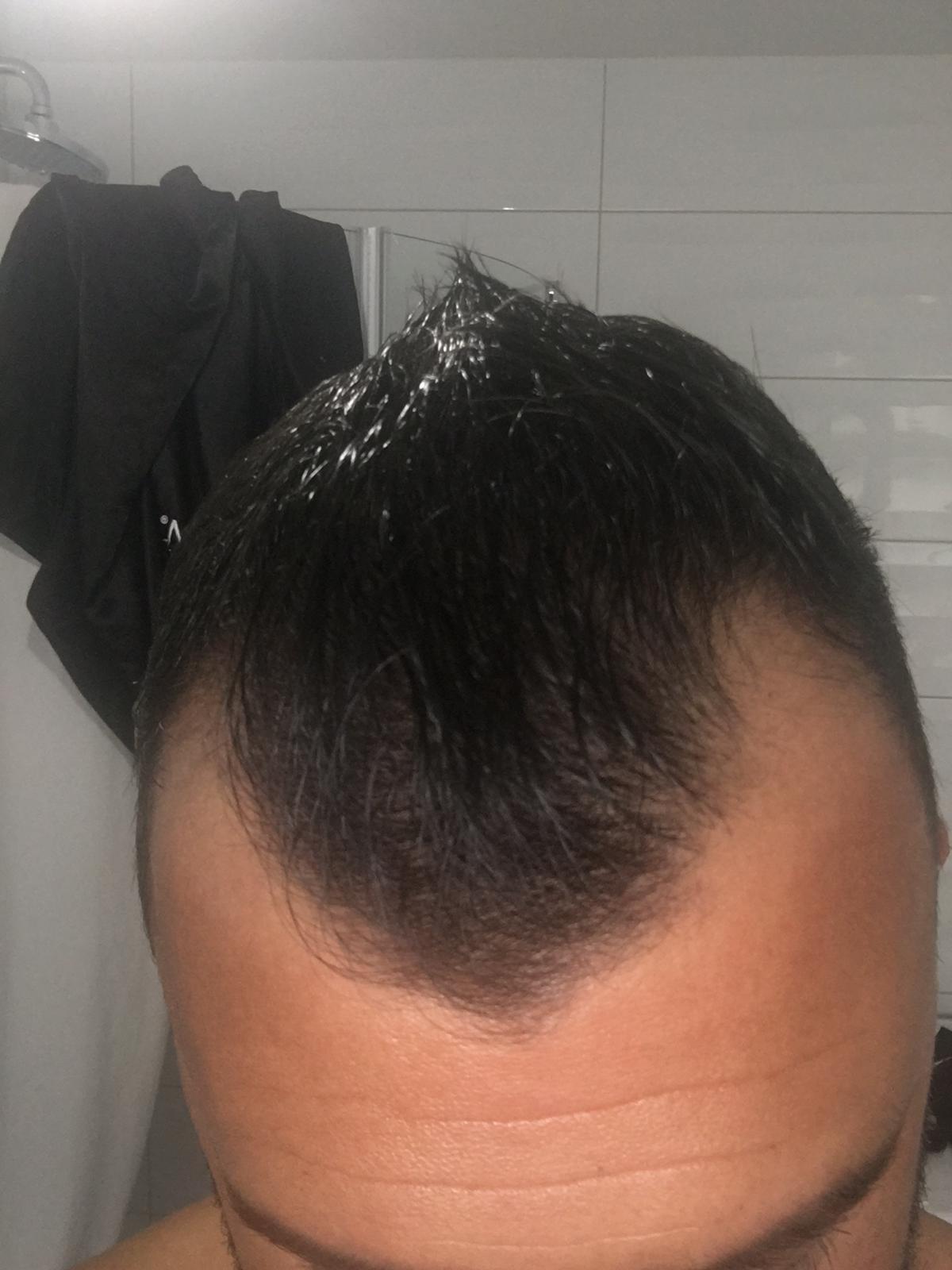 /foren/transplant/index.php/fa/54178/0/