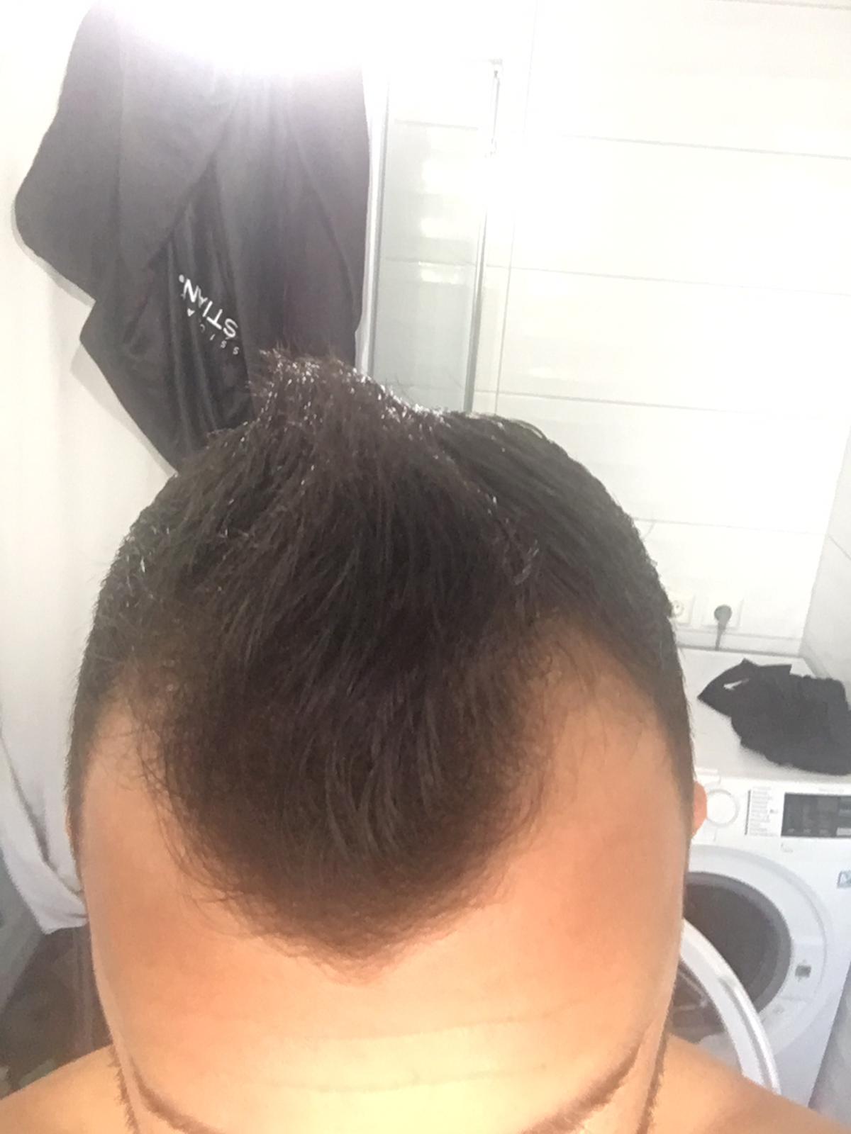 /foren/transplant/index.php/fa/54179/0/