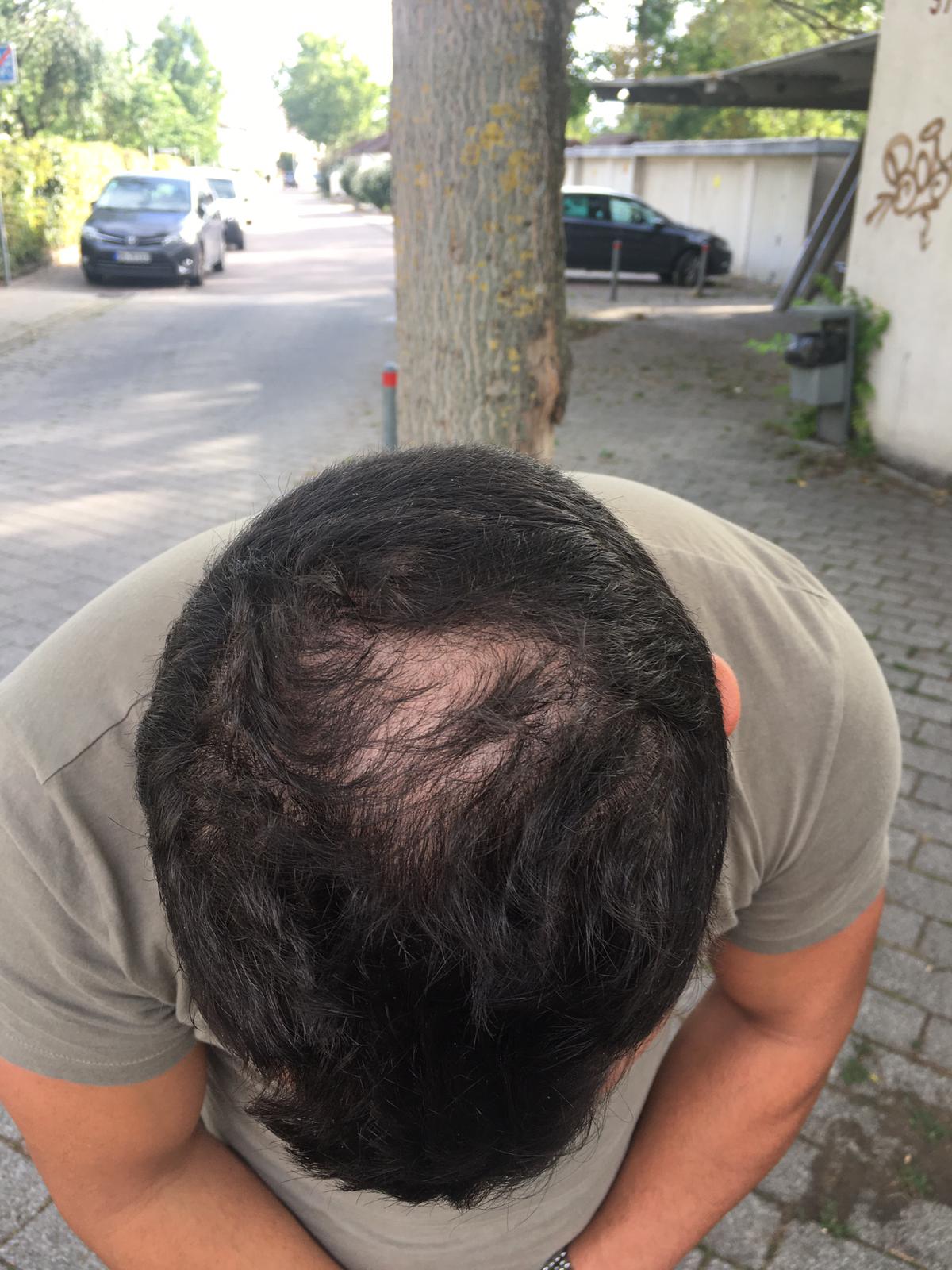 /foren/transplant/index.php/fa/54181/0/