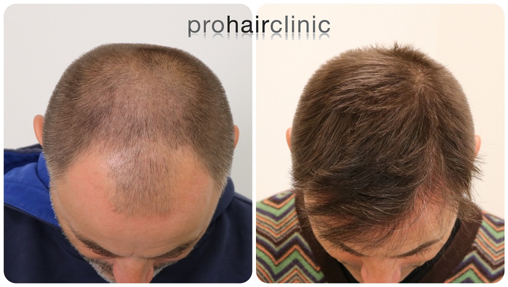 /foren/transplant/index.php/fa/54202/0/