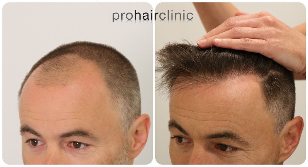 /foren/transplant/index.php/fa/54203/0/