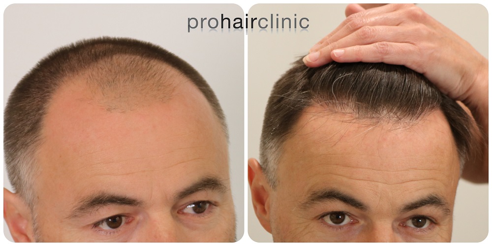 /foren/transplant/index.php/fa/54204/0/