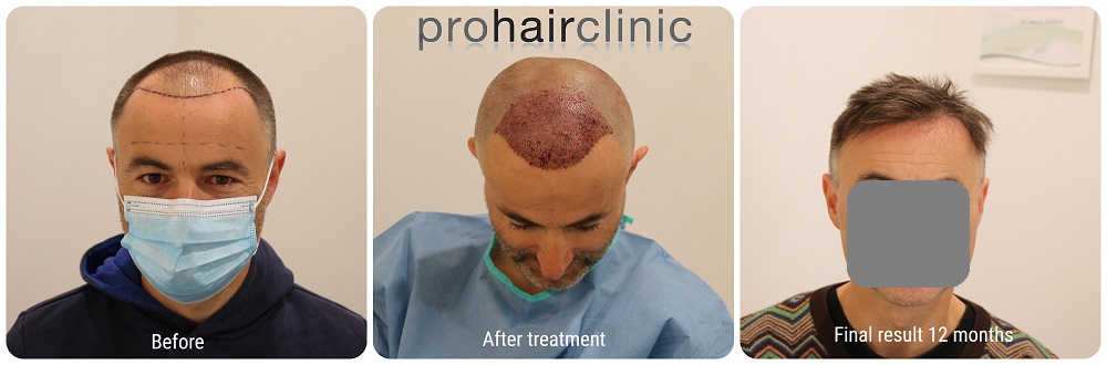 /foren/transplant/index.php/fa/54206/0/