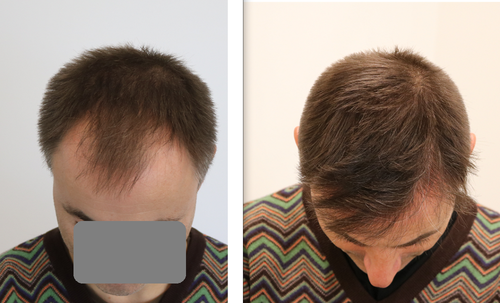 /foren/transplant/index.php/fa/54235/0/