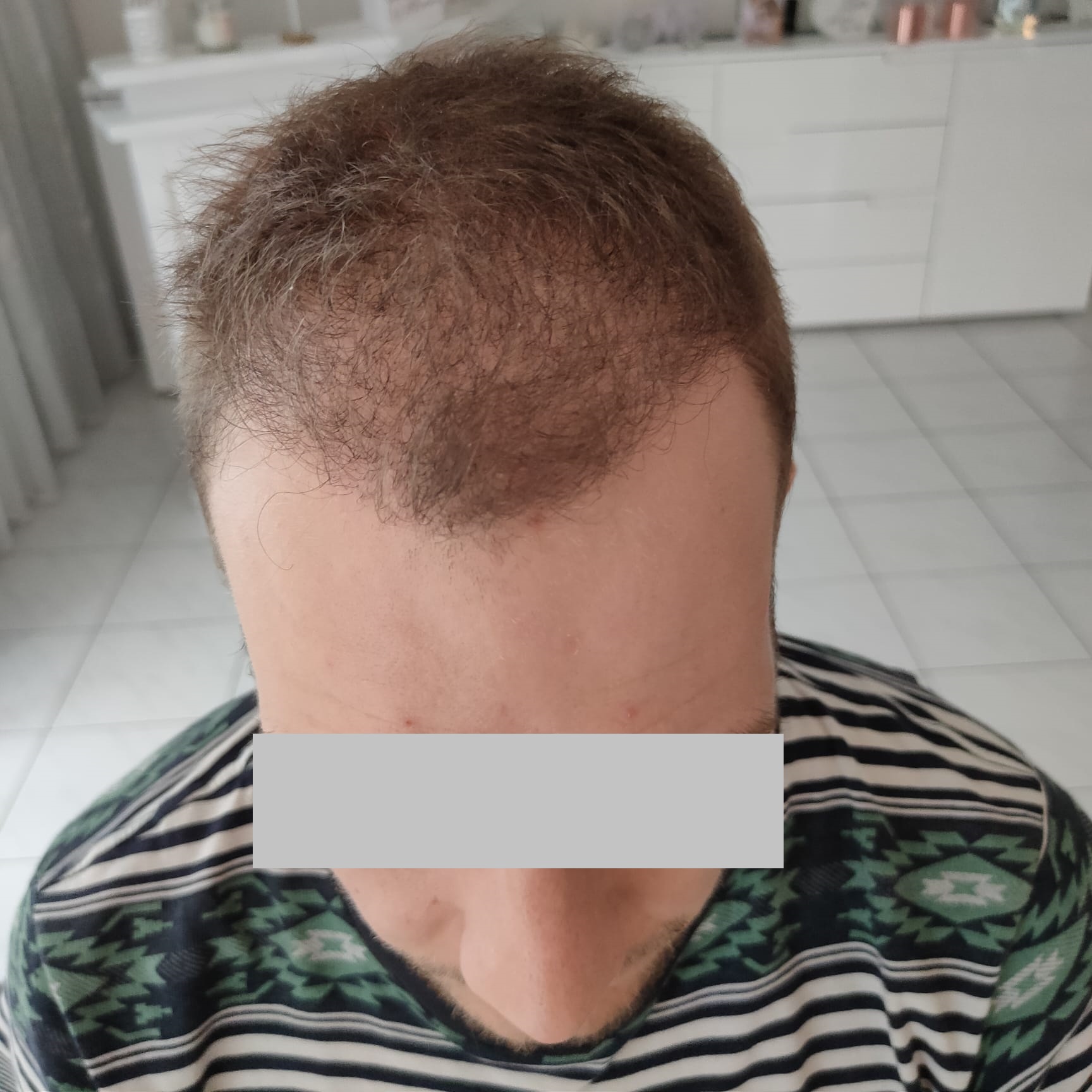 /foren/transplant/index.php/fa/54238/0/