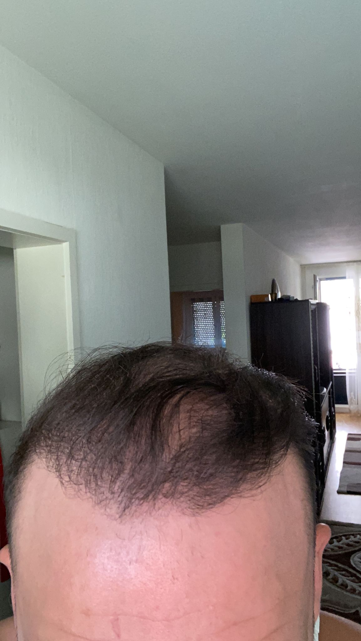 /foren/transplant/index.php/fa/54239/0/