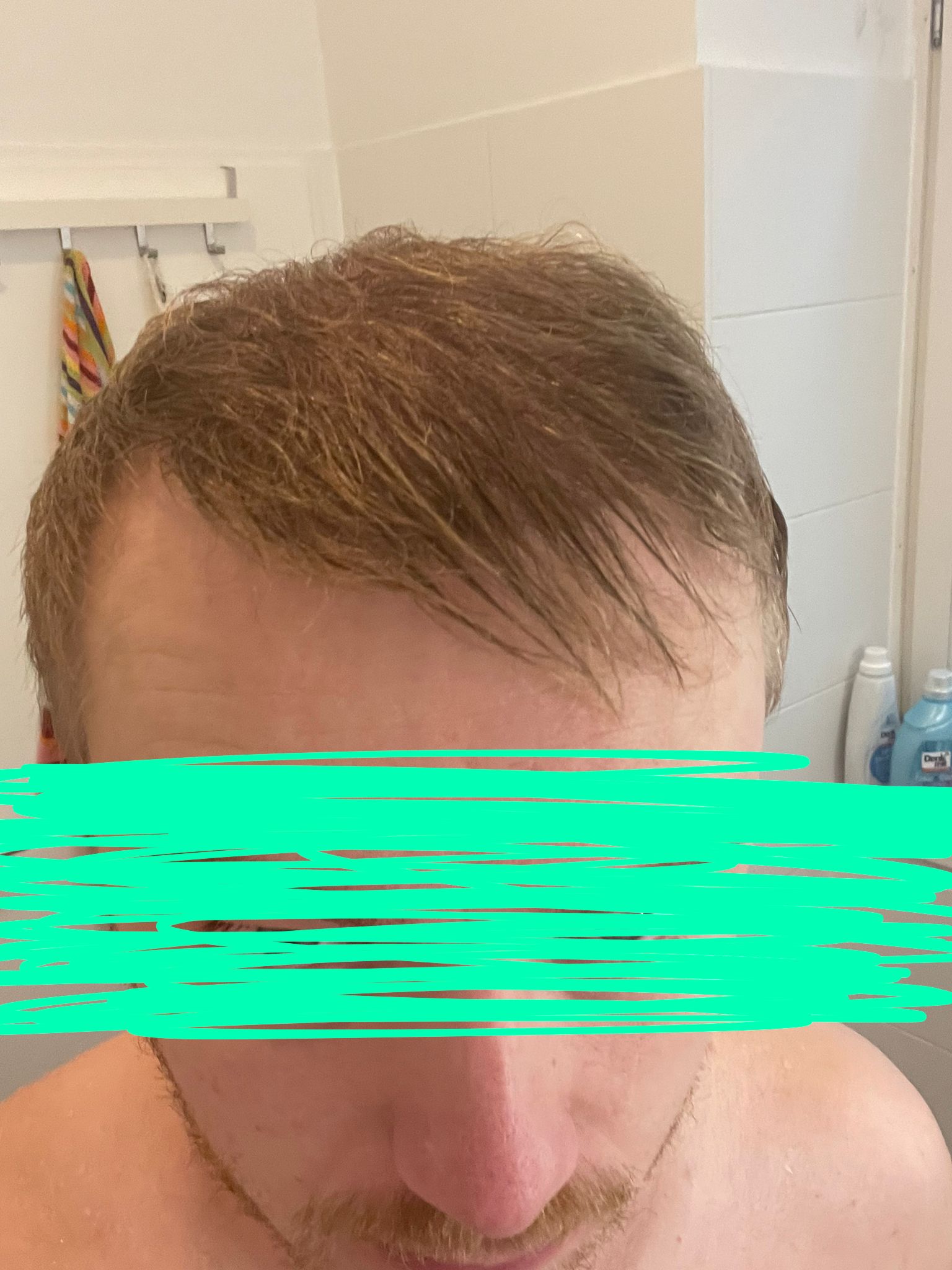 /foren/transplant/index.php/fa/54240/0/