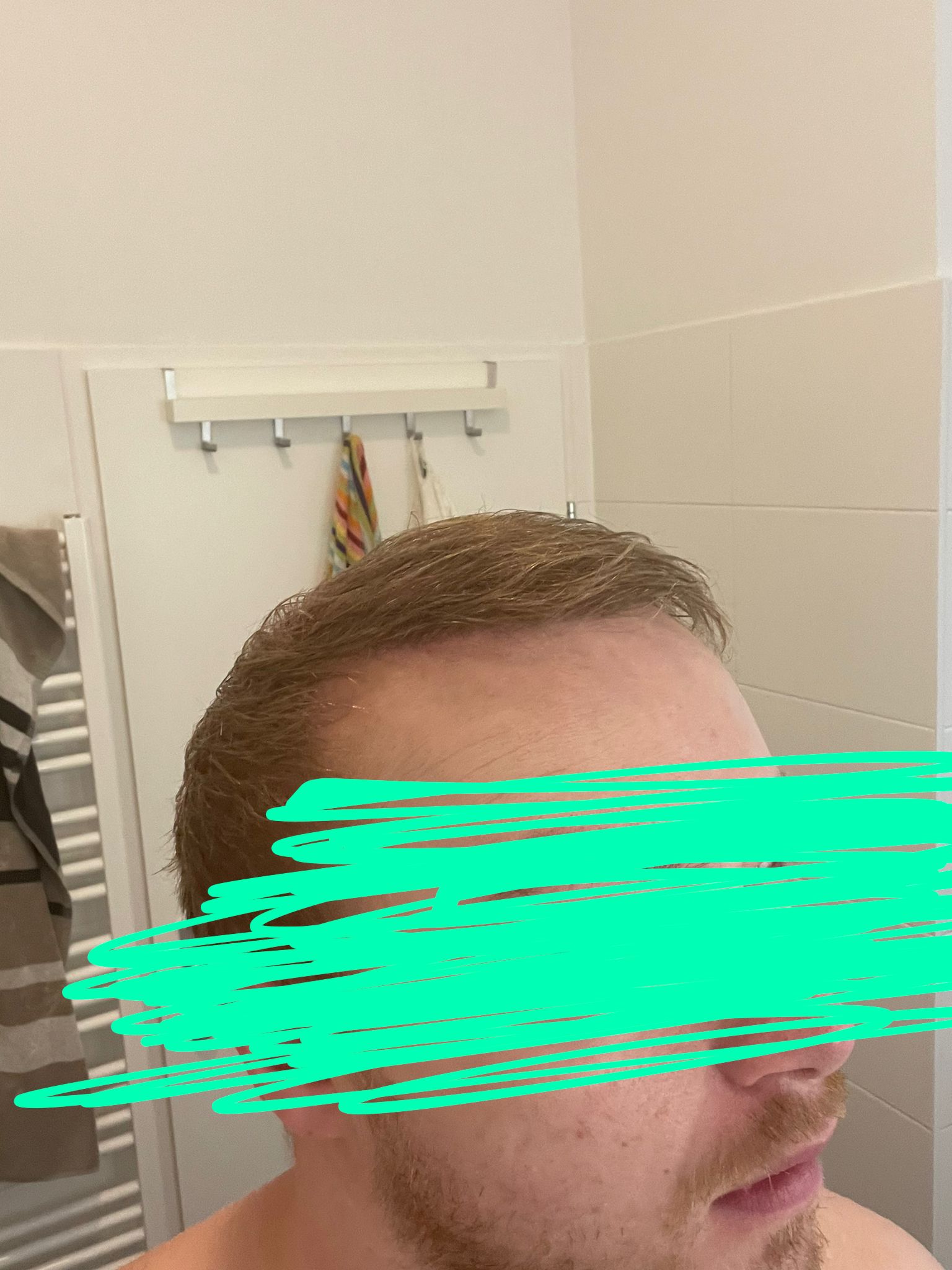 /foren/transplant/index.php/fa/54241/0/