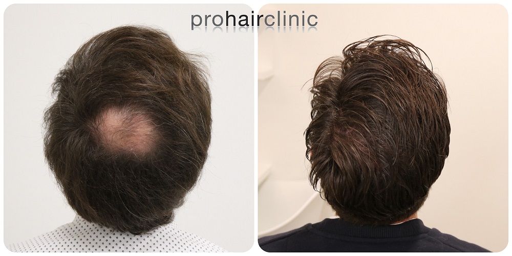 /foren/transplant/index.php/fa/54282/0/