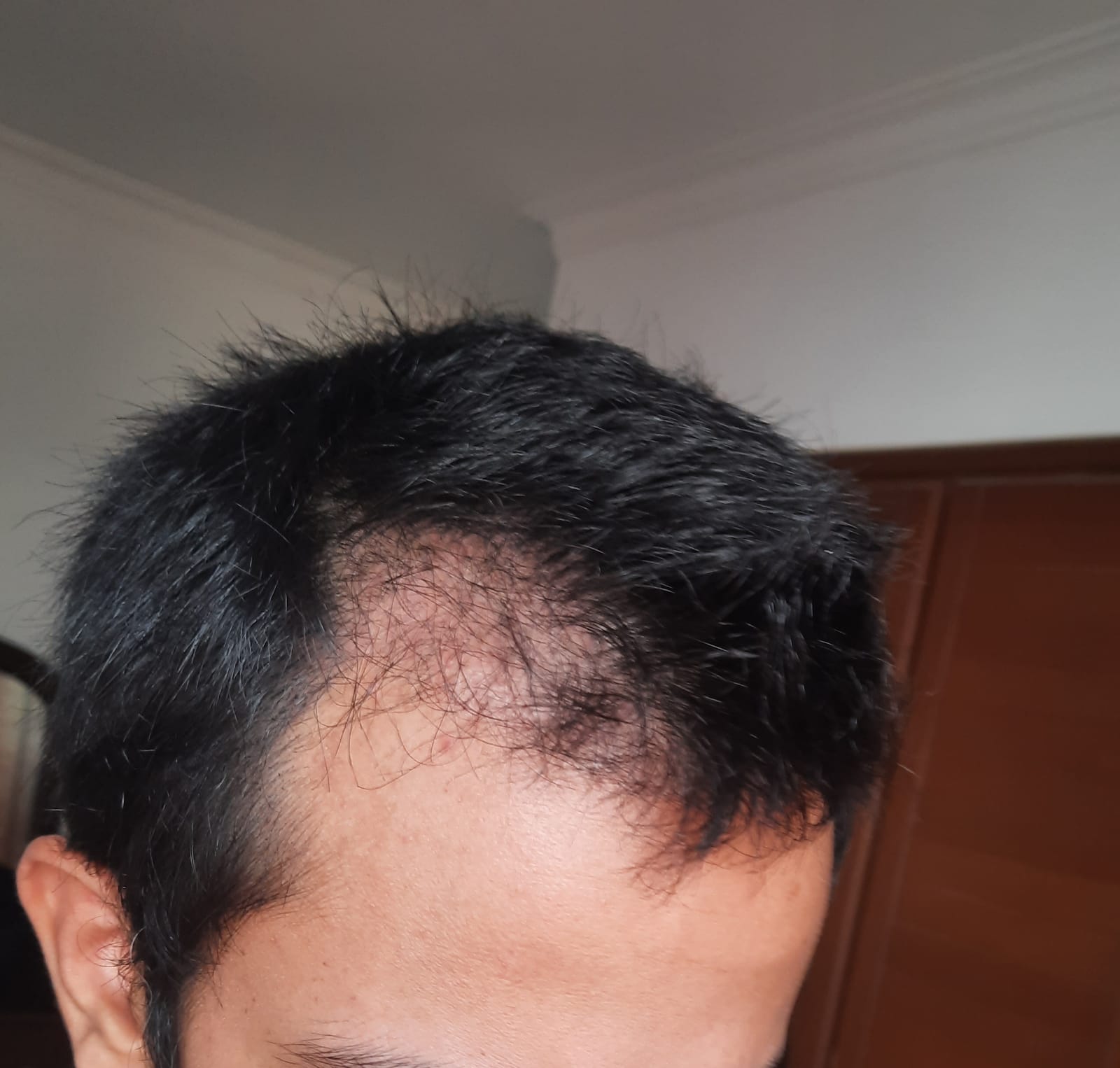 /foren/transplant/index.php/fa/54290/0/