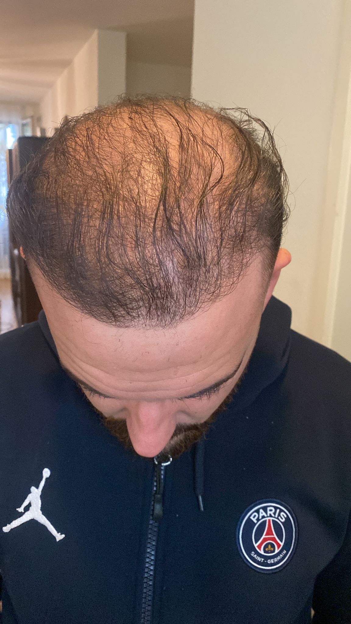 /foren/transplant/index.php/fa/54375/0/