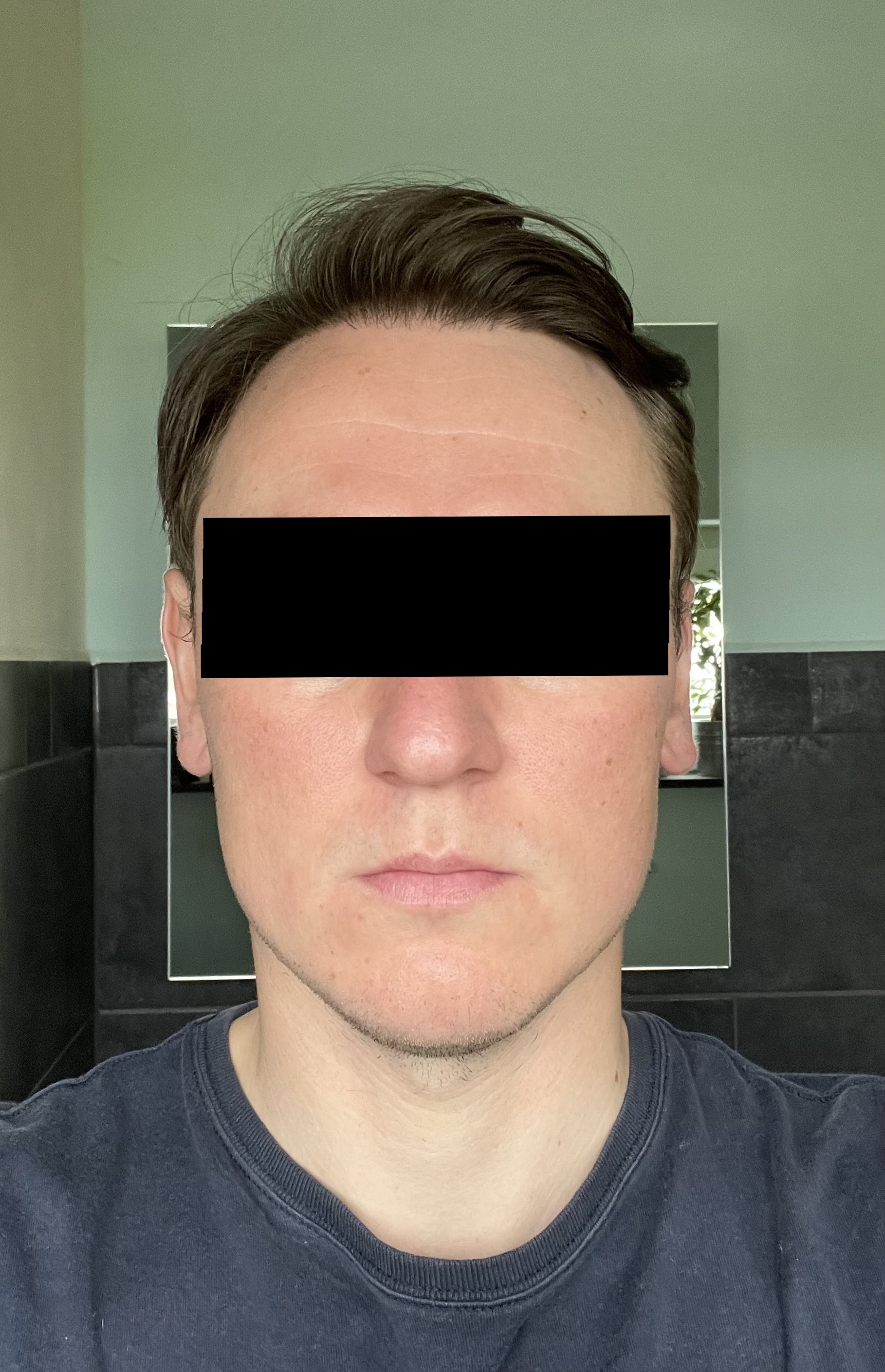 /foren/transplant/index.php/fa/54401/0/