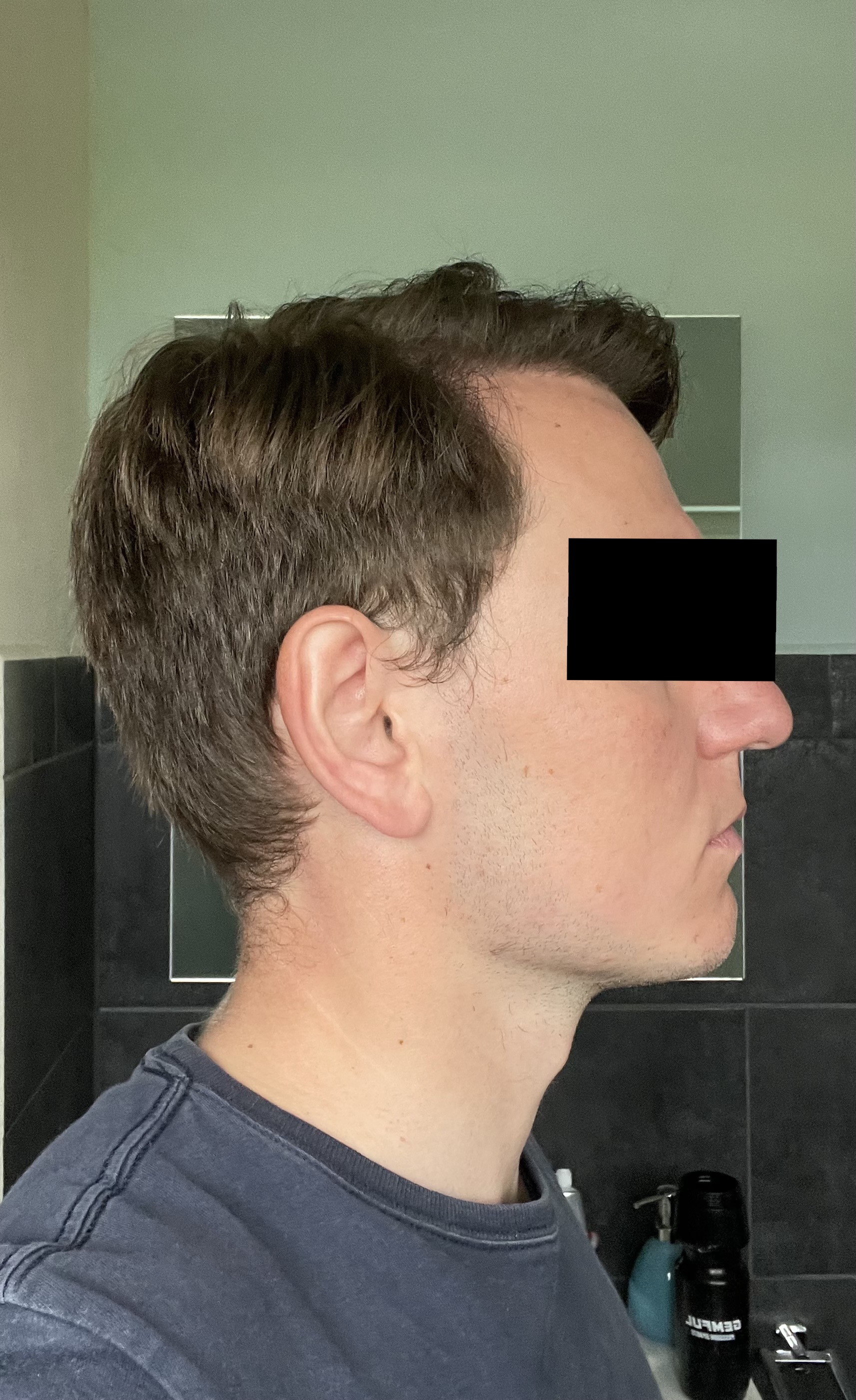 /foren/transplant/index.php/fa/54402/0/