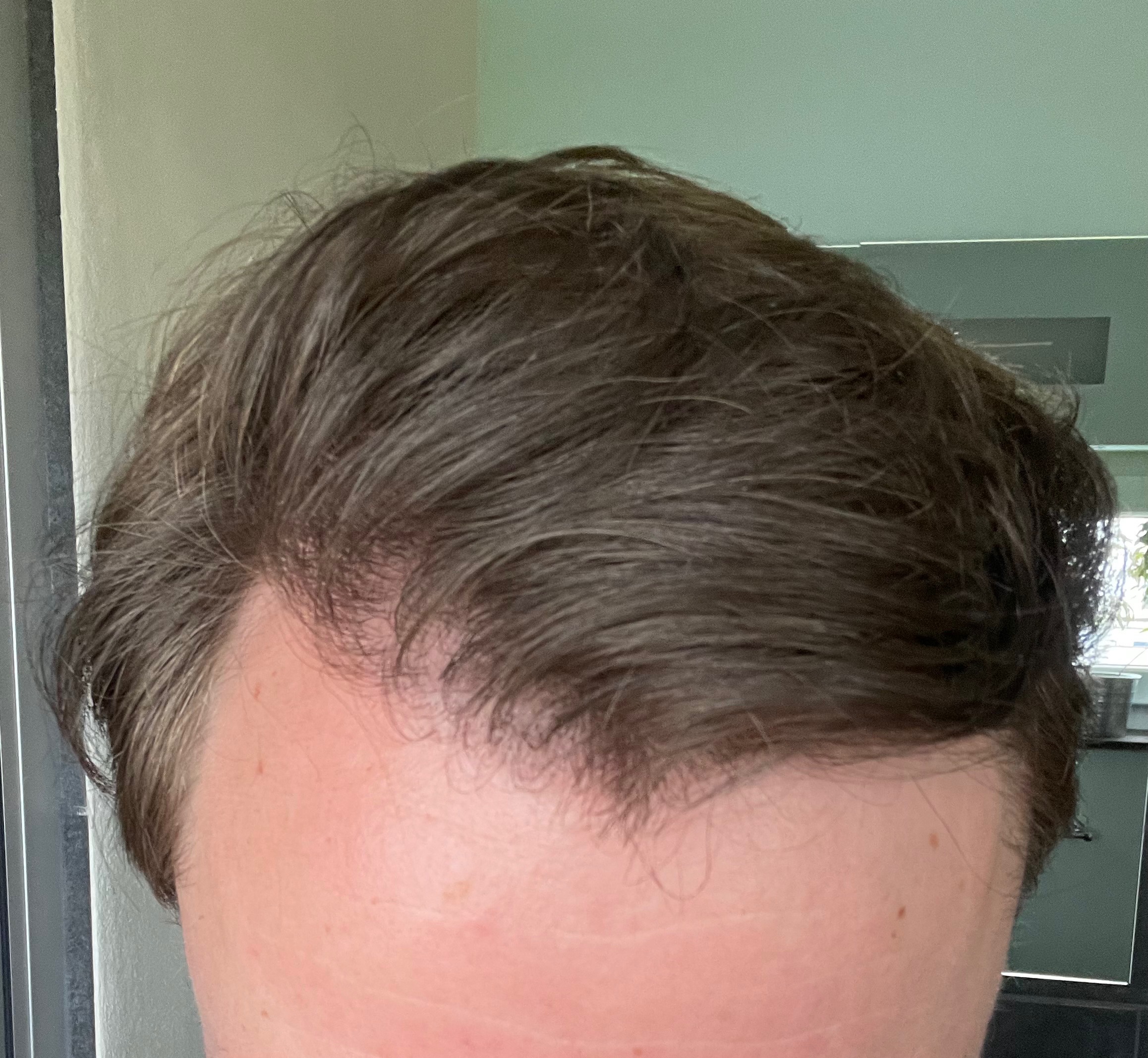 /foren/transplant/index.php/fa/54404/0/