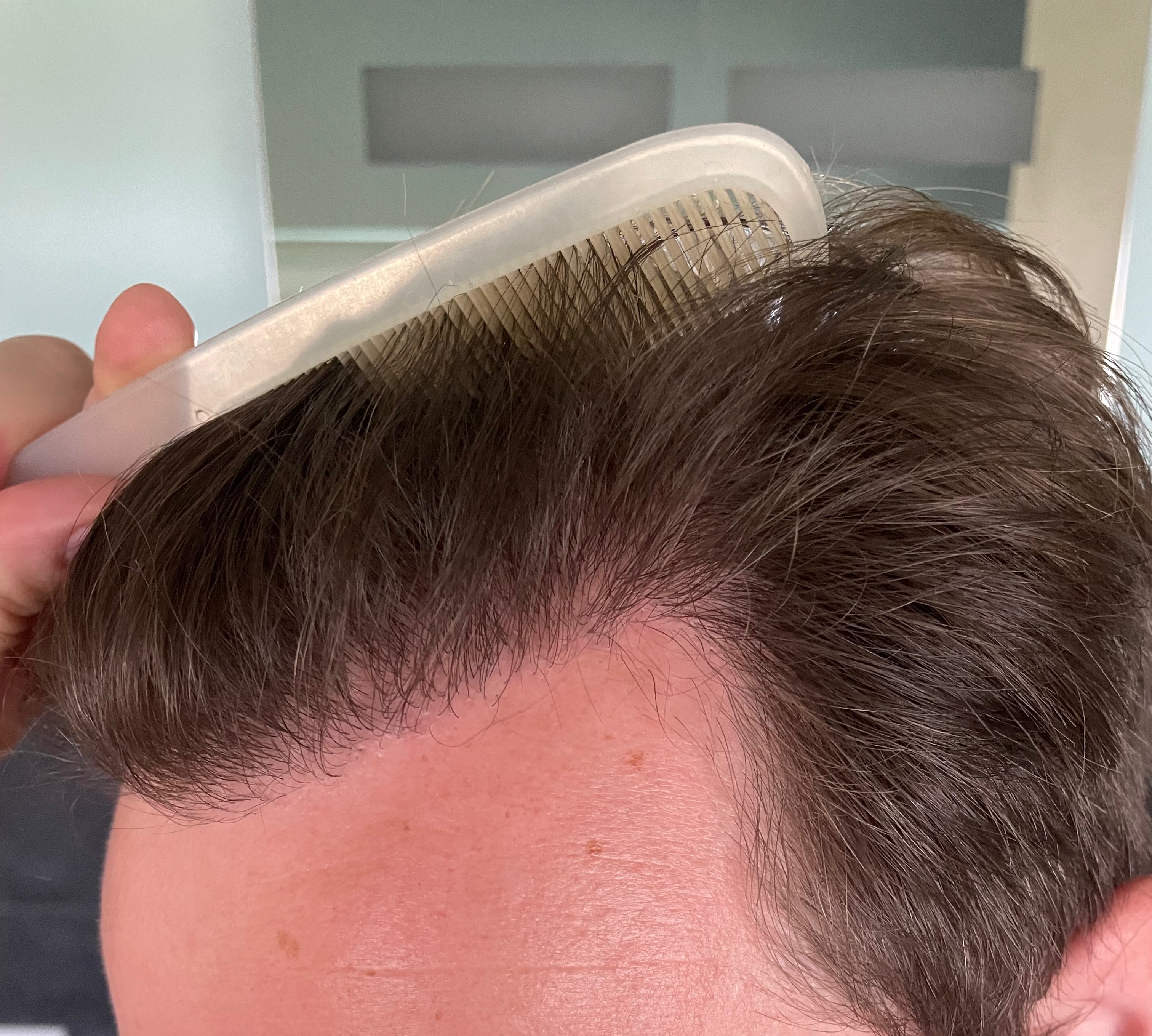 /foren/transplant/index.php/fa/54406/0/