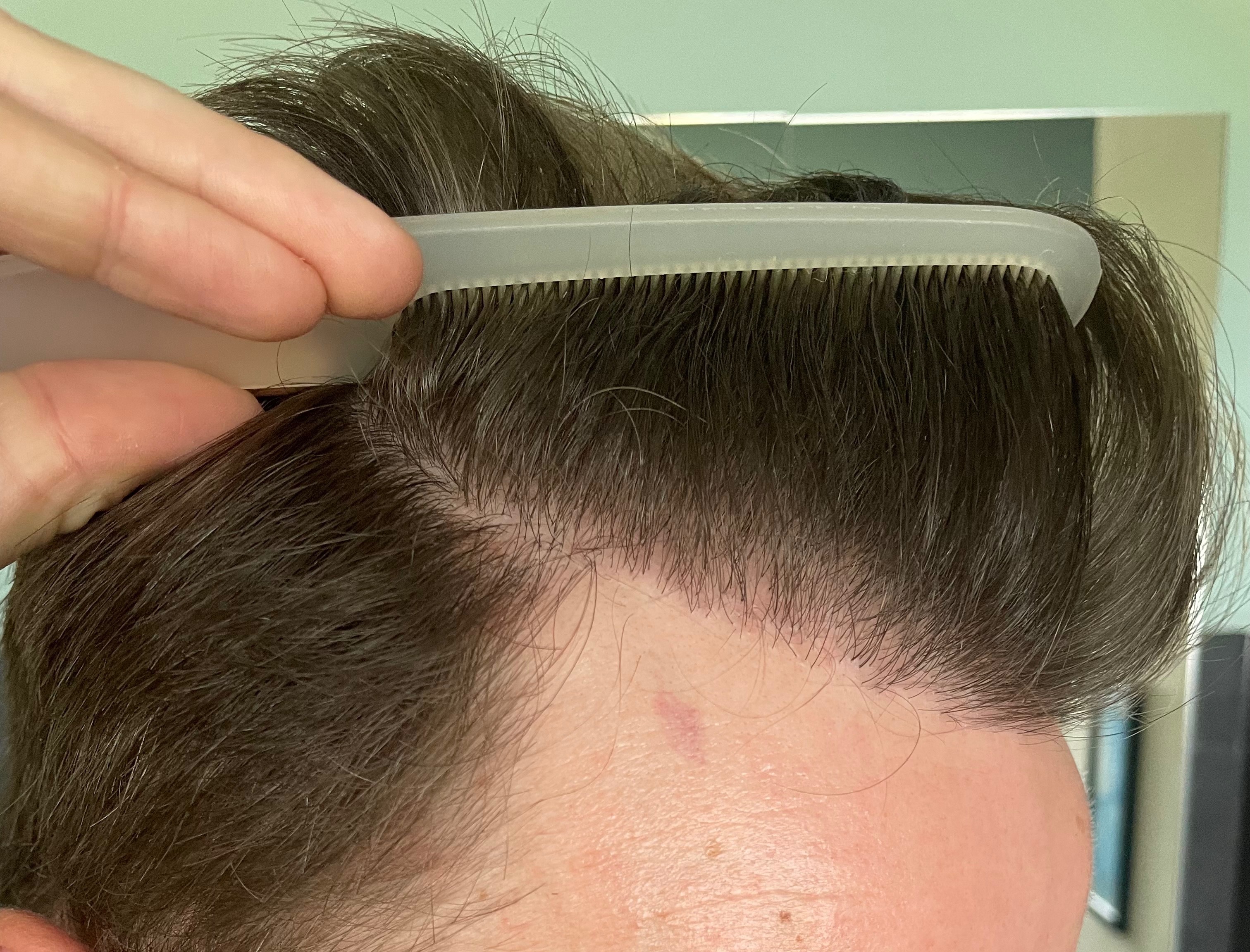 /foren/transplant/index.php/fa/54407/0/