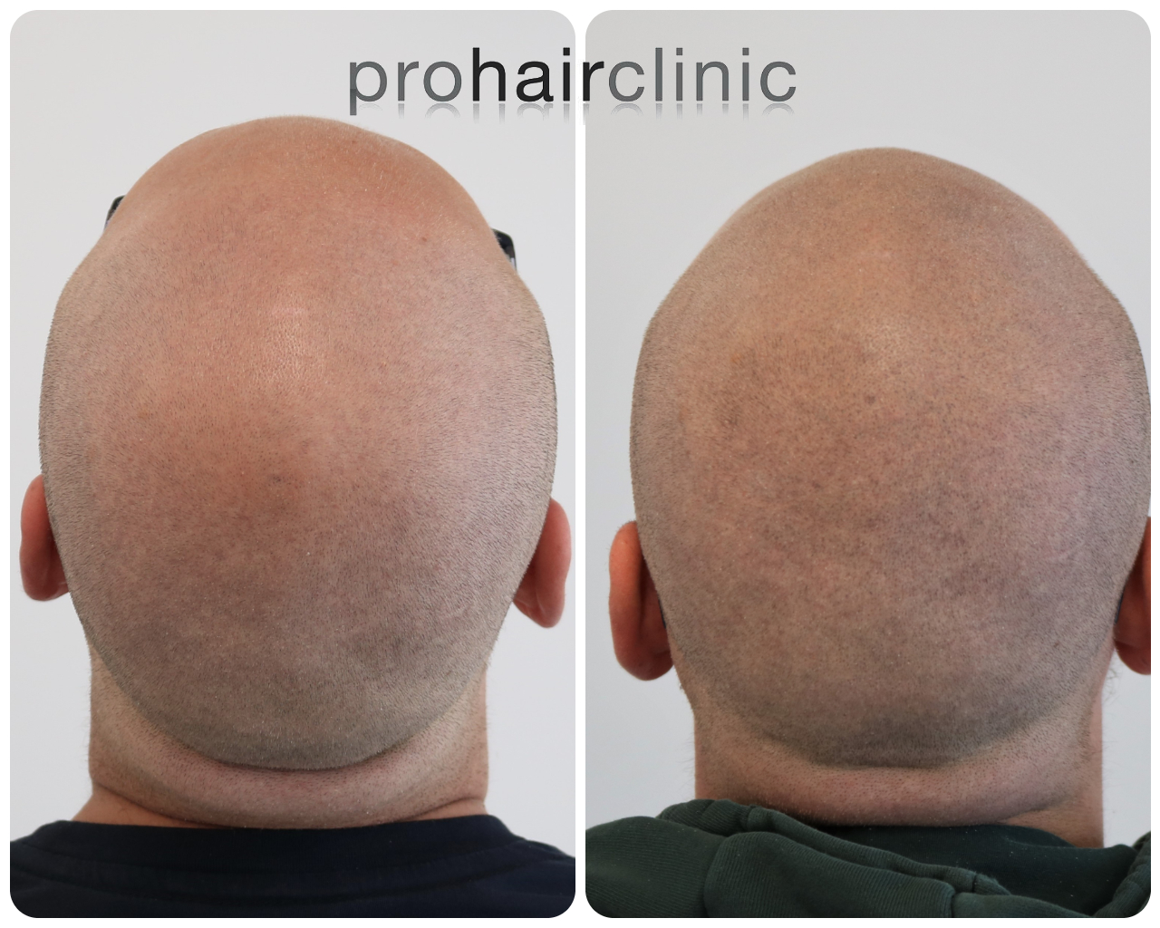 /foren/transplant/index.php/fa/54408/0/