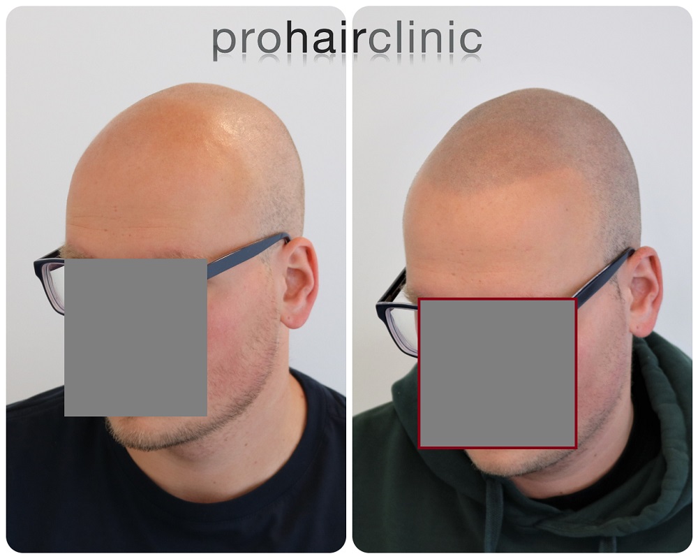 /foren/transplant/index.php/fa/54409/0/