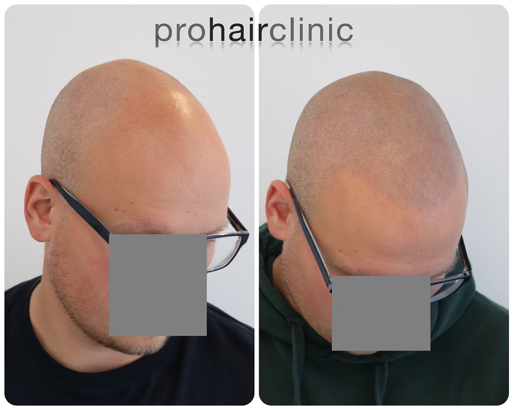 /foren/transplant/index.php/fa/54410/0/