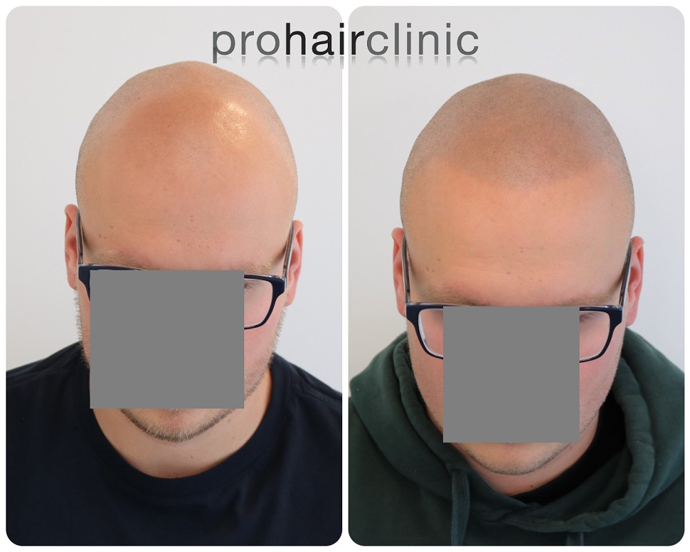 /foren/transplant/index.php/fa/54411/0/