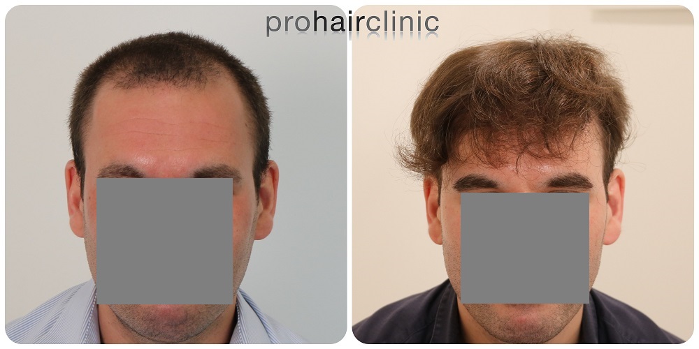 /foren/transplant/index.php/fa/54464/0/