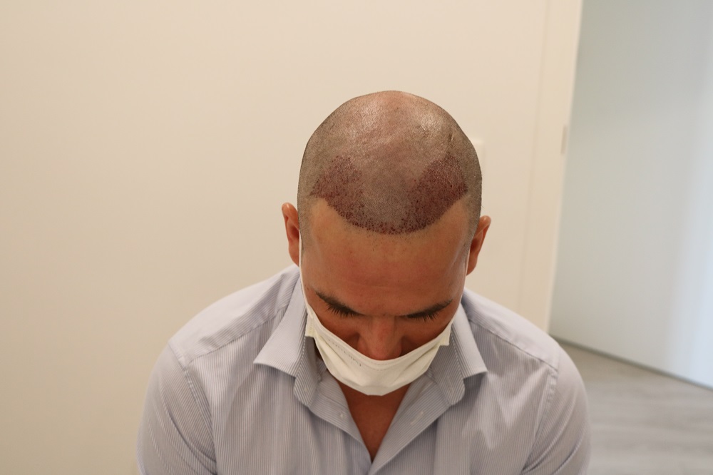 /foren/transplant/index.php/fa/54467/0/