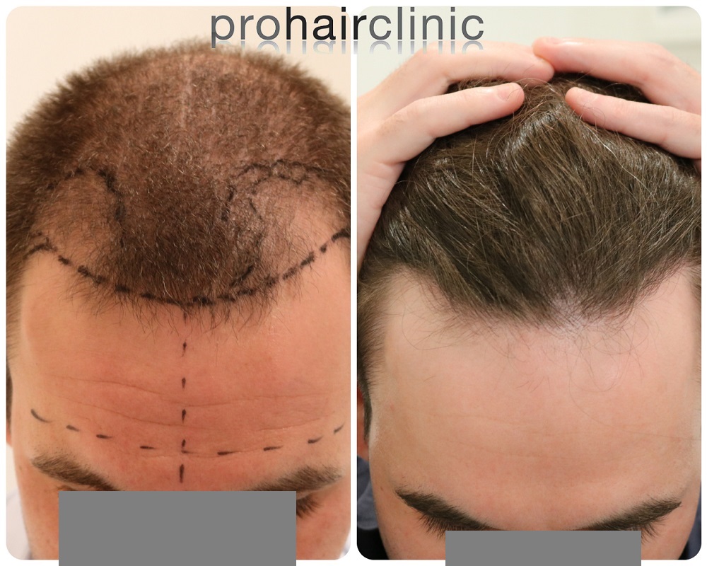 /foren/transplant/index.php/fa/54468/0/