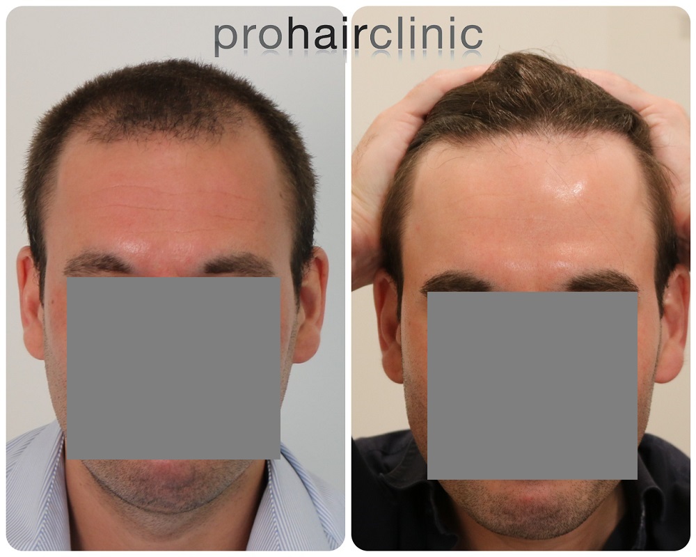 /foren/transplant/index.php/fa/54469/0/