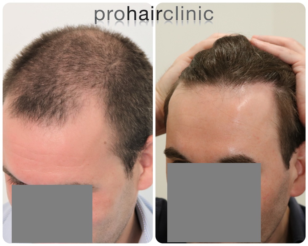 /foren/transplant/index.php/fa/54470/0/