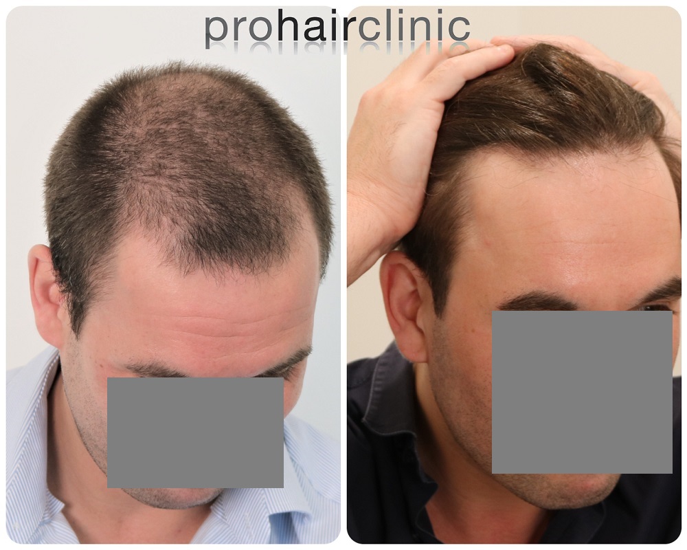 /foren/transplant/index.php/fa/54471/0/