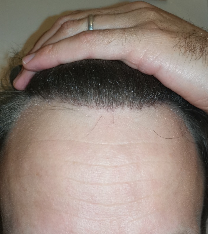 /foren/transplant/index.php/fa/54532/0/